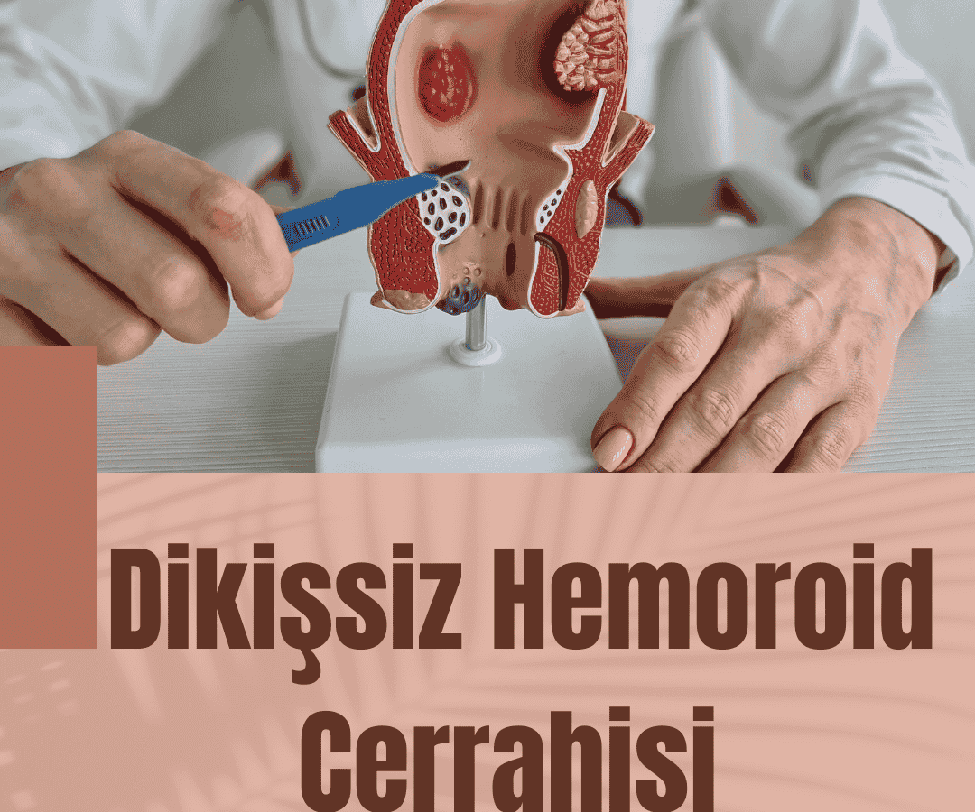 Dikişsiz Hemoroid Cerrahisi Mersin