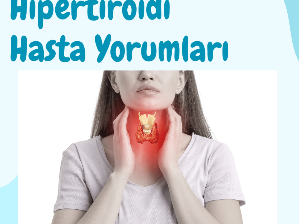 Hipertiroidi Hasta Yorumları
