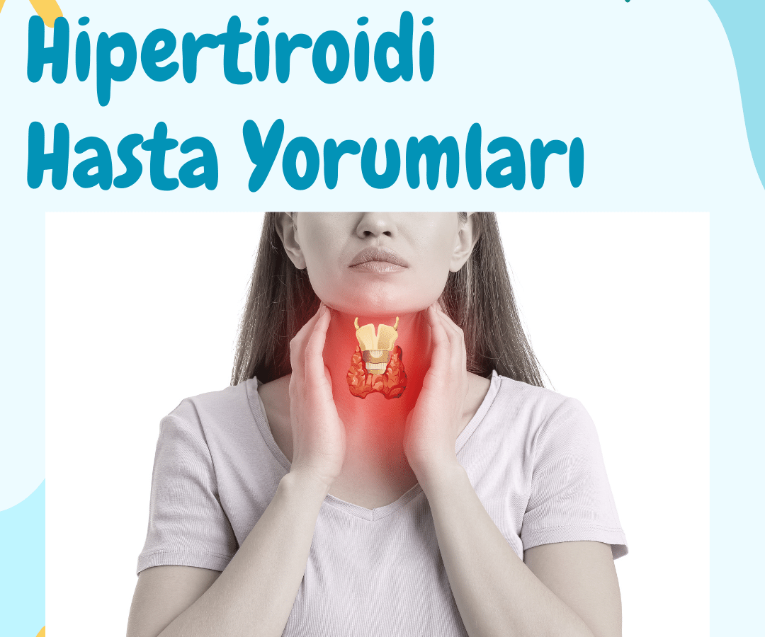 Hipertiroidi Hasta Yorumları