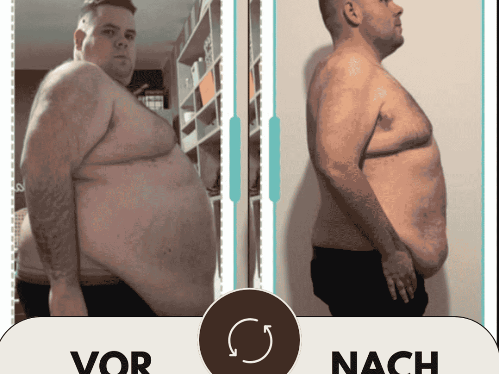 Magenverkleinerung Türkei