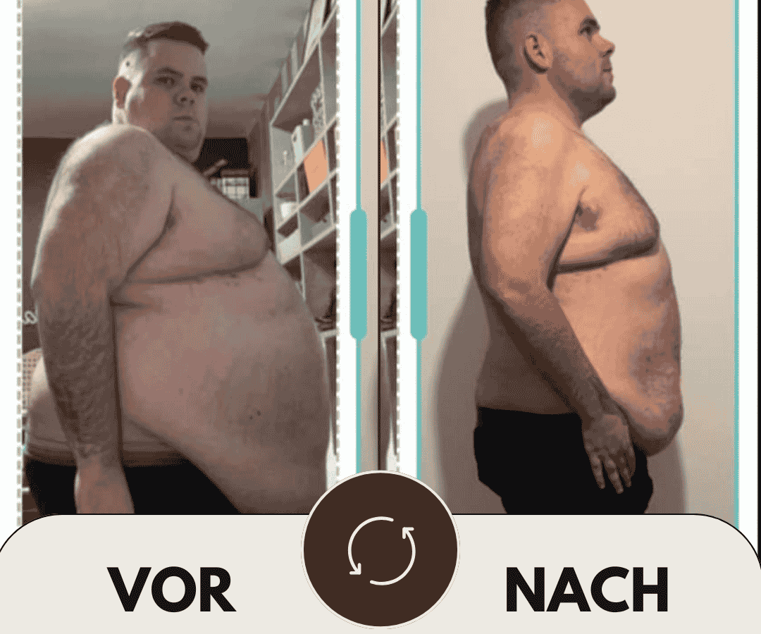 Magenverkleinerung Türkei