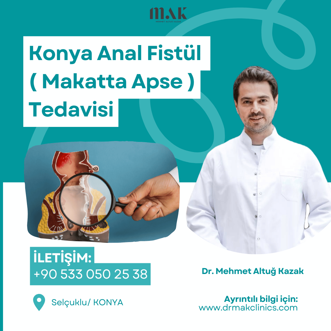 Konya Anal Fistül ( Makatta Apse ) Tedavisi