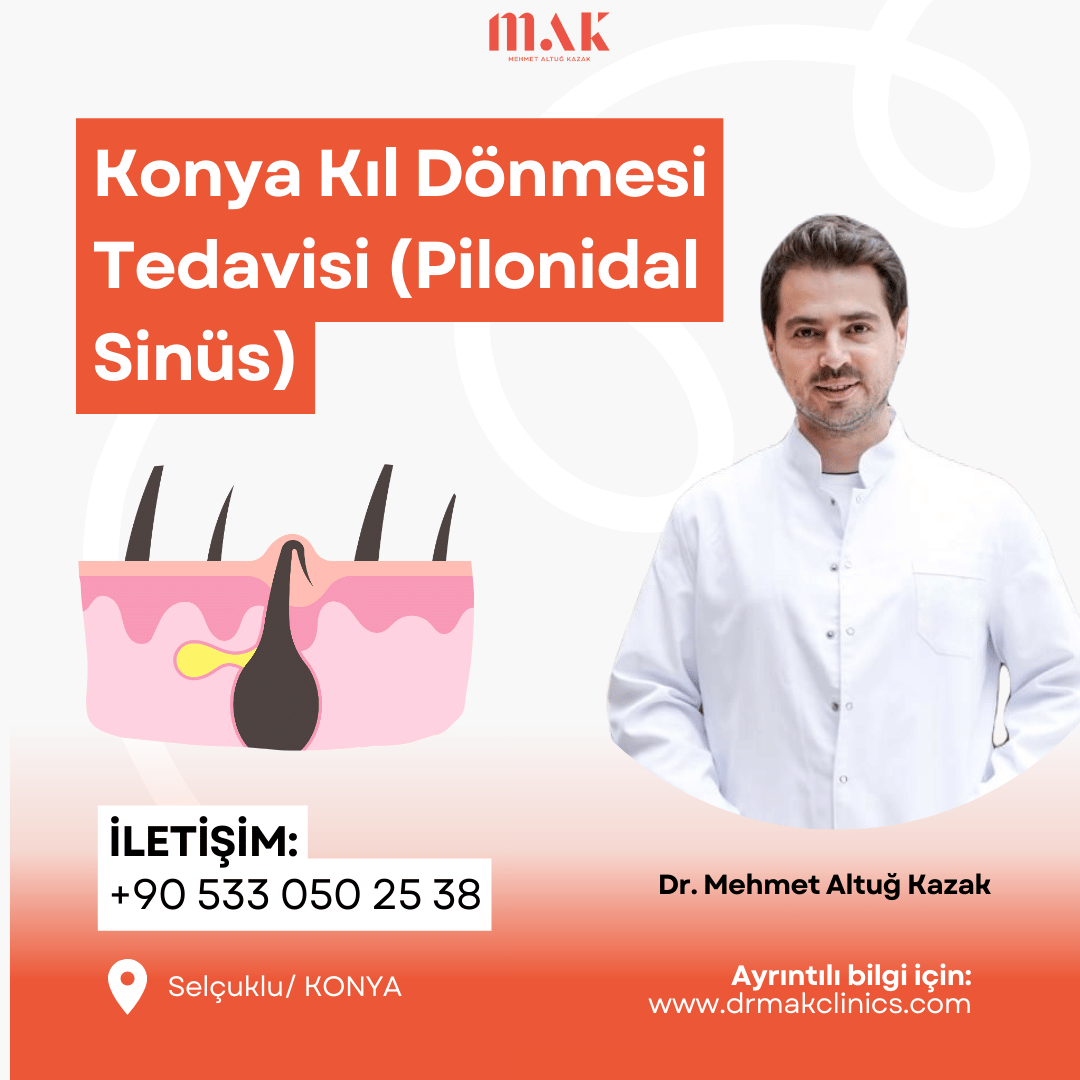 Konya Kıl Dönmesi Tedavisi